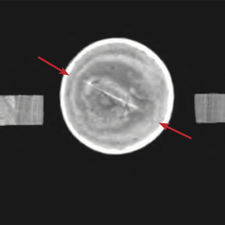CT scan d’une coupe presque tangentielle à la sphère, le fond blanc est plein car la coupe se trouve complètement au sein de la coque. La ligne claire indique l’assemblage des deux hémisphères. © SIK|ISEA